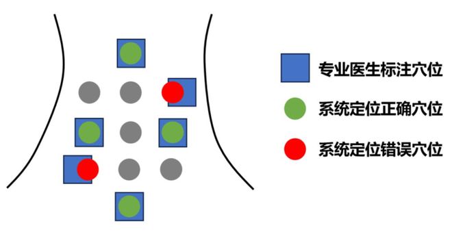 九游智能体育科技：基于AI深度学习的中医针灸实训室腹针穴位智能辅助定位系统开发(图6)